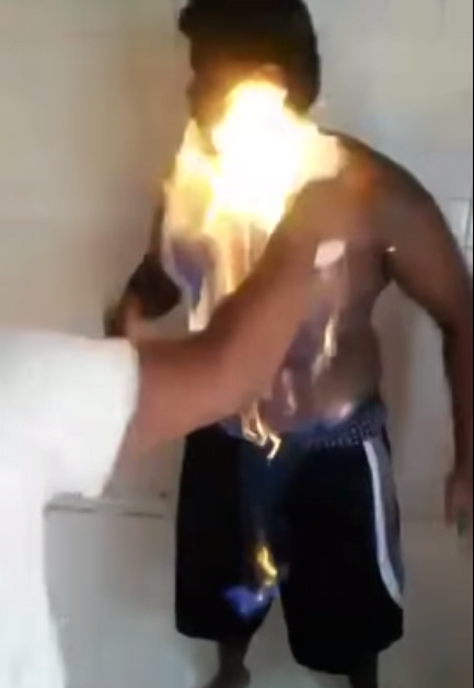 Adolescente coloca fogo em si próprio