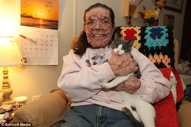 Mulher com o rosto coberto por tumores aprende a conviver com a aparência