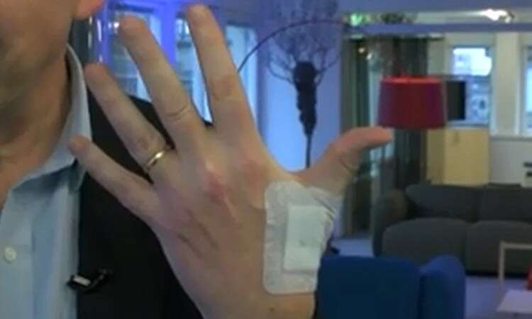Escritório causa polêmica ao fazer com que funcionários implantem chips nas mãos para substituir crachás 