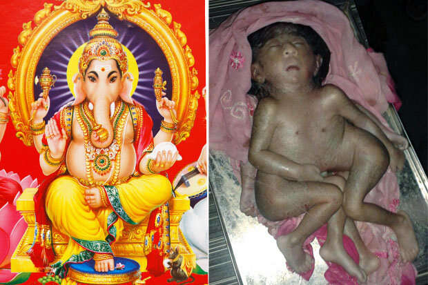 Bebê nasce com oito membros e é adorado como deus na Índia