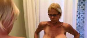 Mulher com seios de 13 quilos passa por cirurgia para remover implante que estourou, mesmo correndo risco de morte