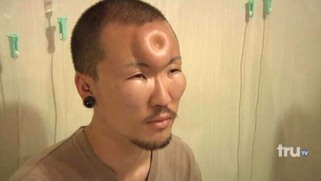 Tendência bizarra no Japão faz pessoas colocarem rosca na testa