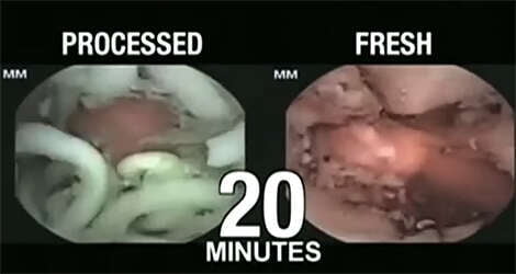 Vídeo assustador mostra o que acontece no estômago quando ingerimos macarrão instantâneo