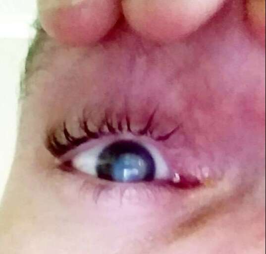 00