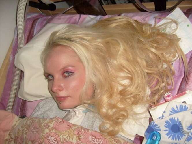 Primeira Barbie humana tetraplégica do mundo afirma que se parecer com a boneca lhe ajuda a lidar com a paralisia