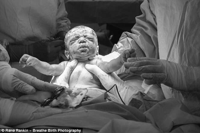 Imagens impressionantes mostram mãe dando à luz seu próprio bebê por cesariana