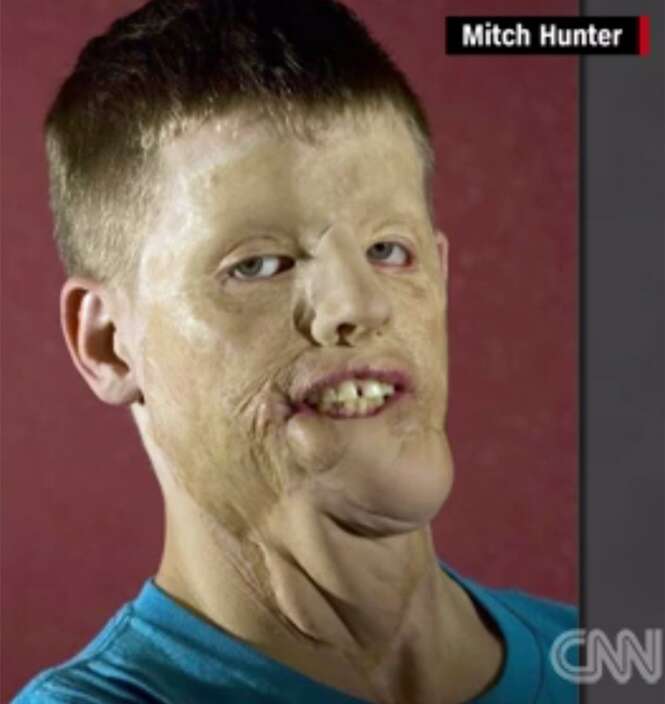 Foto: CNN
