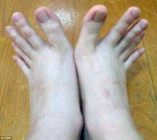Mulher confunde internautas após postar fotos de deus dedos dos pés... ou será das mãos?