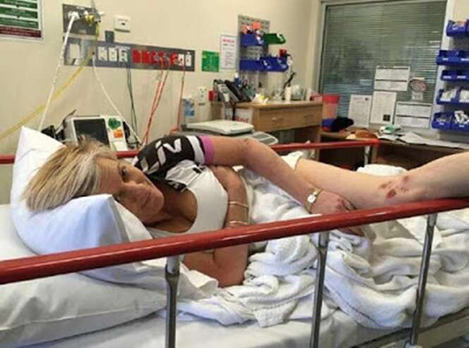 Silicone explode após mulher ser atacada por canguru