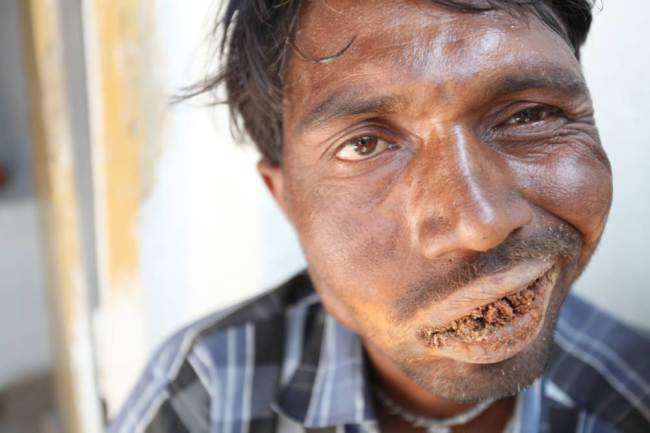 Pakkirappa Hunagundi  é viciado em comer tijolos