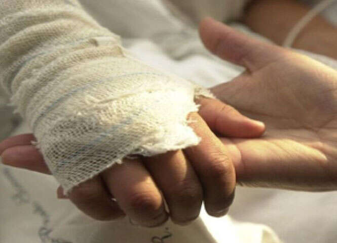 Mãe cortou dedos da mão esquerda do filho após briga com marido