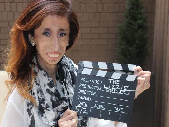 Lizzie Velasquez