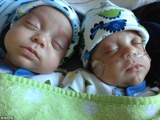 Gêmeos nasceram com 39 dias de intervado