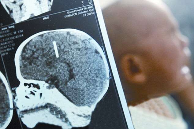 Mum Inserts Nails Into Sons Brains