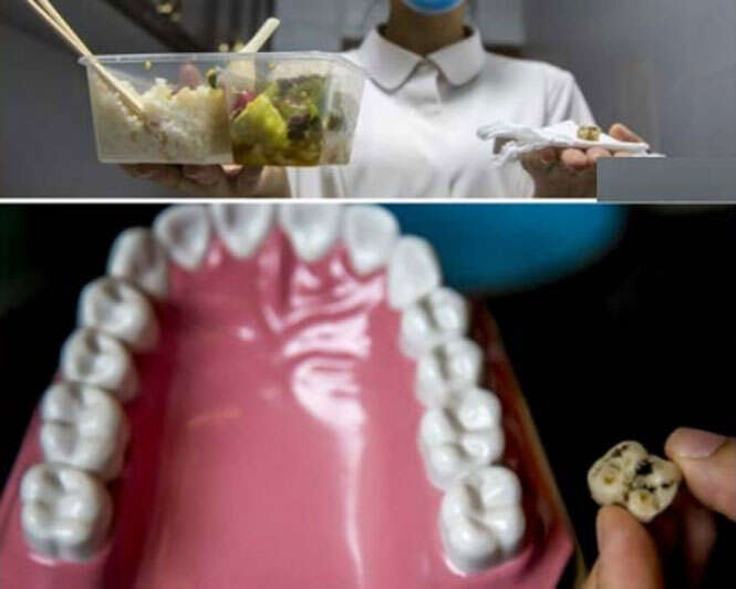 Dente no almoço