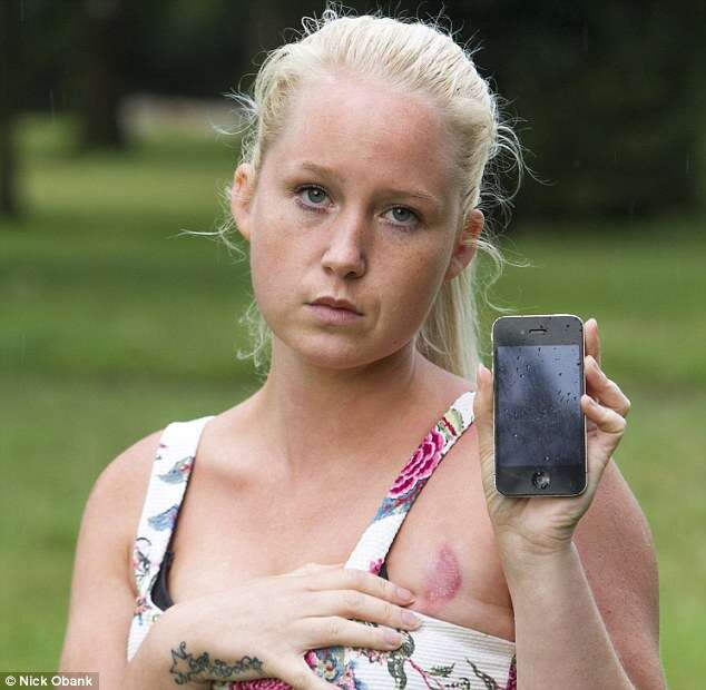 Mulher sofre graves queimaduras no peito após iPhone explodir