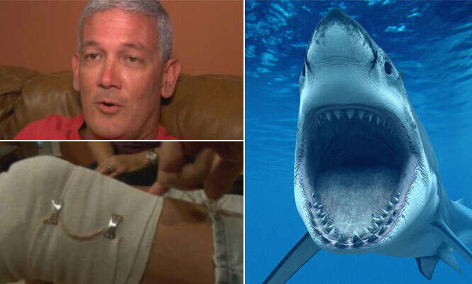 Homem sobrevive a ataque de tubarão