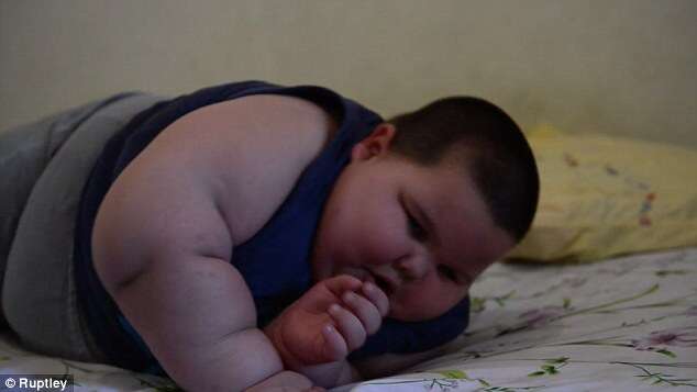 Menino de 3 anos pesa 40 quilos por cota de síndrome rara