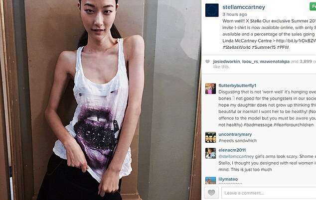 Estilista deixa fãs revoltados ao postar foto de modelo extremamente magra em rede social