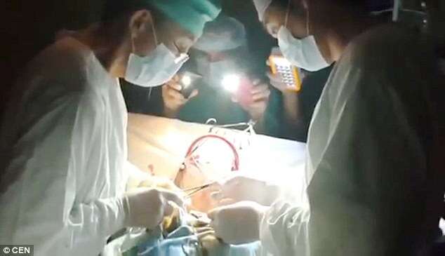 Médicos são forçados a terminar cirurgia de coração usando lanterna de celulares