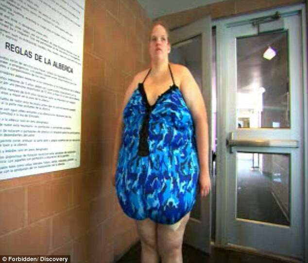 Mulher que julga obesidade como “obra-prima” afirma que vai engordar ainda mais
