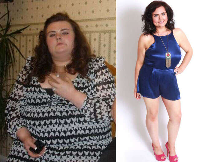 Mulher perde 82 quilos por ser gorda demais para ter relaçãoes íntimas