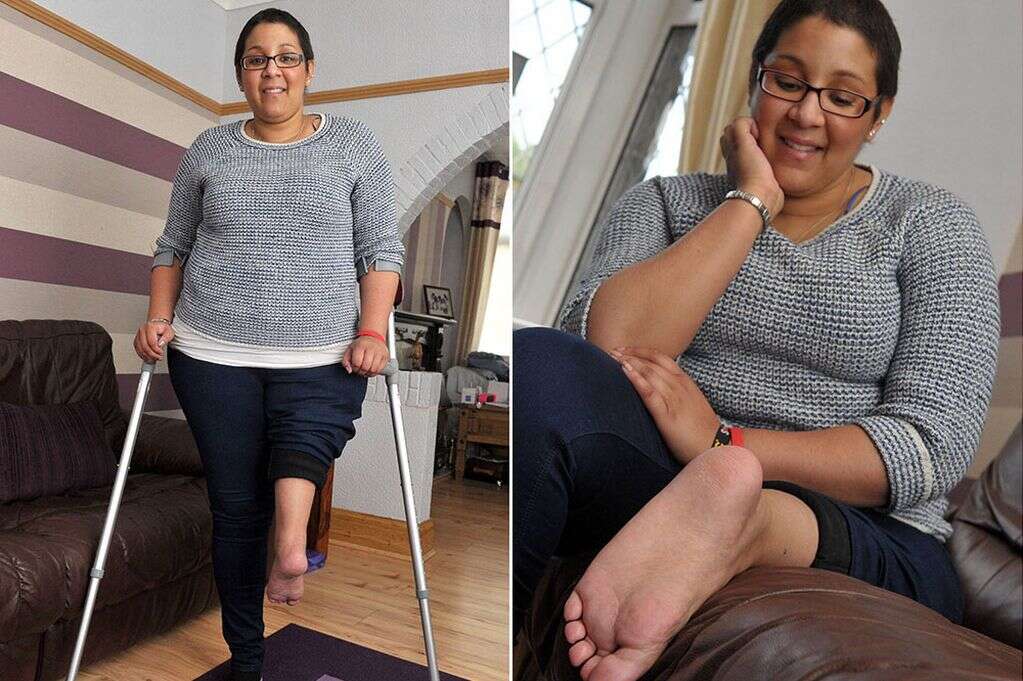 Mulher tem pé colocado no joelho em cirurgia