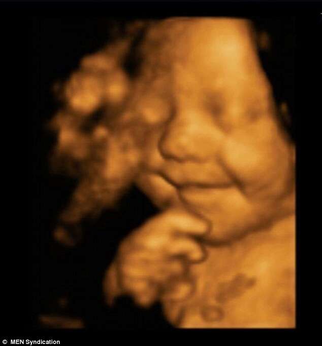 Bebê flagrado sorrindo em ultrassom, se torna sensação após nascer e manter rosto sempre alegre