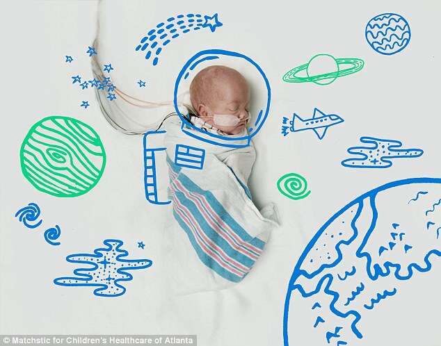 Enfermeiras usam a criatividade para criar ilustrações de bebês prematuros