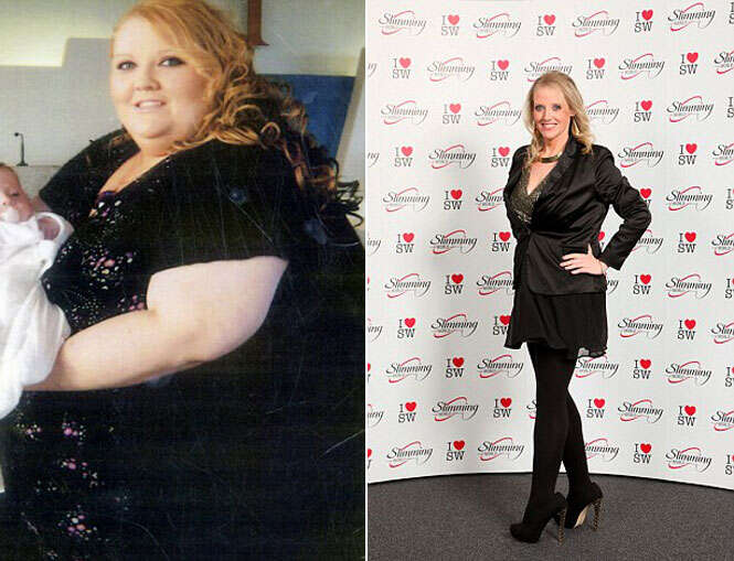 Obesa de 27 anos perde 129 quilos