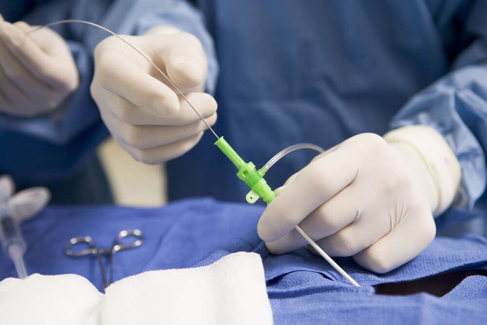 Primeiro transplante de órgão genital masculino pode ser realizado em breve, de acordo com teste de pesquisadores