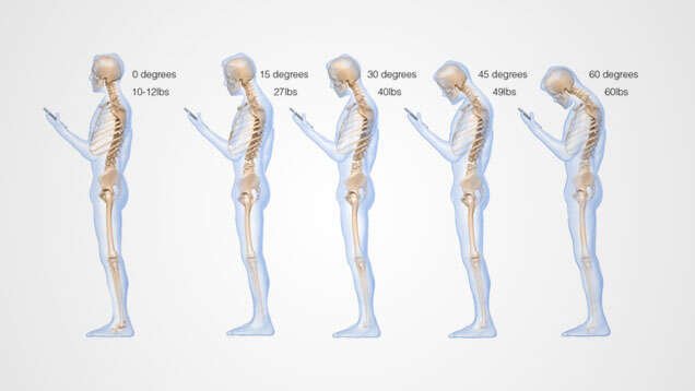 Uso de smartphone causa problemas na coluna