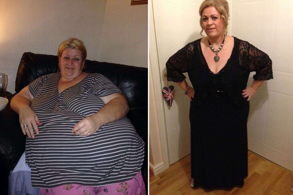 Толстую маму скрыто. Super morbidly obese woman lemfidema Gino.