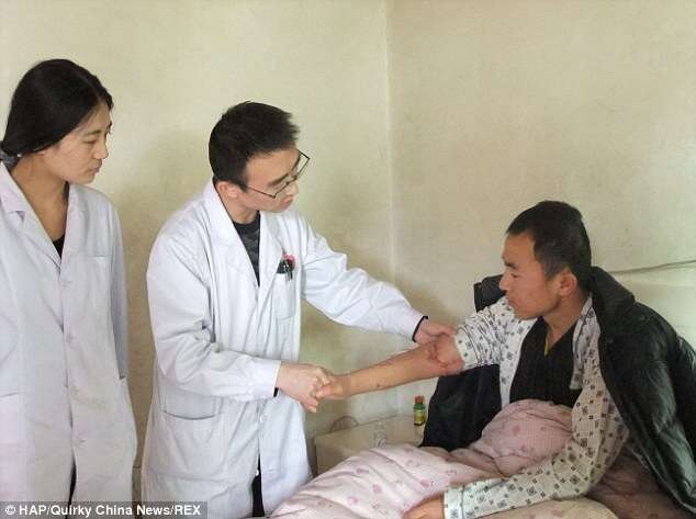 Médicos recolocam braço em homem após membro ser completamente arrancado