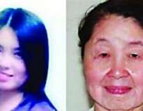 Mulher de 28 anos com doença rara que a faz ter rosto de 70 procura cirurgia plástica