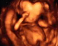 Exame de ultrassom deixa grávida chocada ao mostrar bebê com cabeça em formato de coração