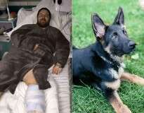 Homem quase perde a perna após ser arranhado por cão de estimação durante brincadeira e contrair grave infecção