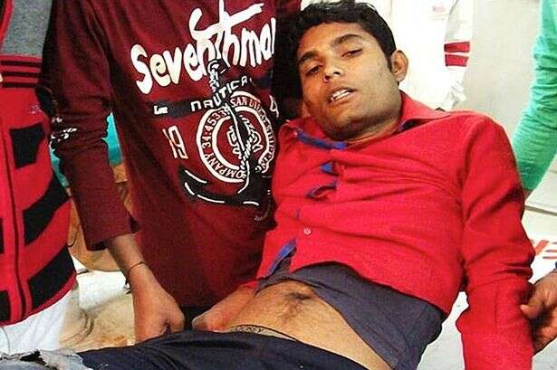 Homem com barra de ferro penetrada no ânus vai parar no hospital Homem com barra de ferro penetrada no ânus vai parar no hospital