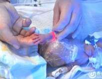 Mulher dá à luz gêmeos quíntuplos e bebês lutam para sobreviver