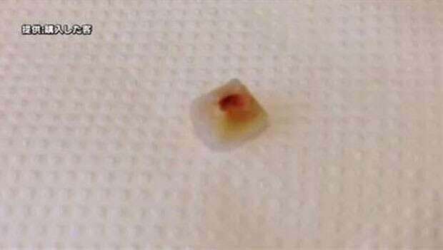 Um dente humano é encontrado em batatas fritas do McDonalds