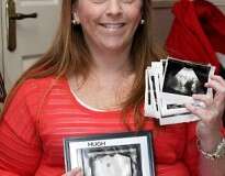 Mulher com dois úteros e duas vaginas supera condição rara e dá à luz bebê saudável após 14 anos de tentativas