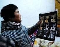 Mulher tem rim roubado após cirurgia de suposto câncer na China