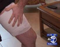 Homem fica com queimaduras graves na perna após iPhone explodir no bolso durante funeral de seu primo