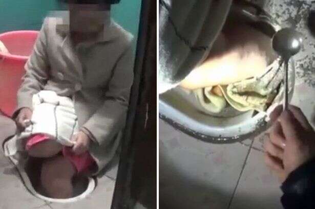 Mulher e é salva graças a uma colher após ficar com pé preso em vaso sanitário