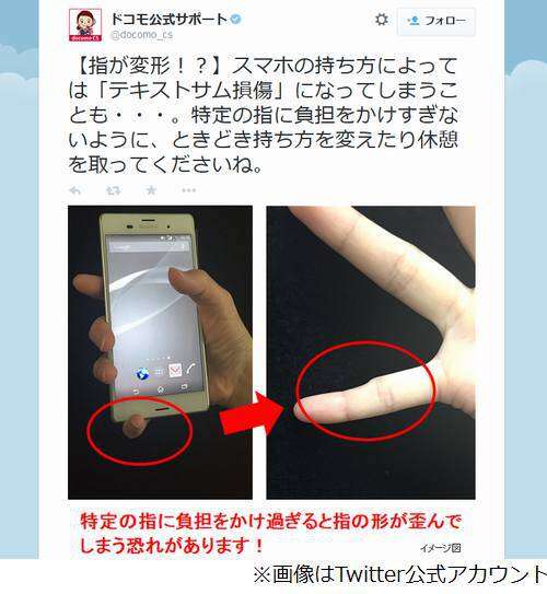 O uso de smartphones em excesso pode causar deformidade nos dedos