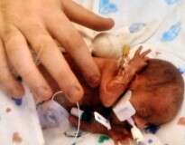 Bebê que nasceu pesando 400 gramas recebe alta do hospital