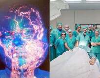 Primeiro transplante completo de rosto do mundo é realizado após 27 horas de operação