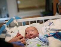 Bebê com condição extremamente rara nasce sem nariz