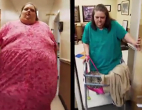 Obesa de 275 quilos que ficou paralisada devido ao peso muda de vida para conseguir voltar a andar