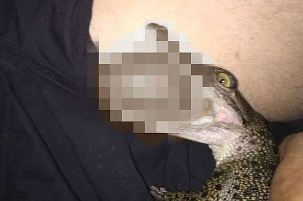 Imagem de crocodilo mordendo testículos de homem causa repercussão na internet